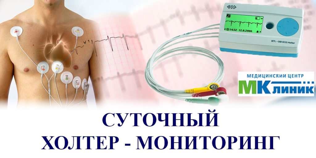 Суточный холтер-мониторинг